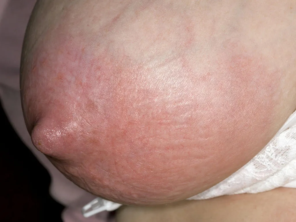 Známky mámy a zdá se, že