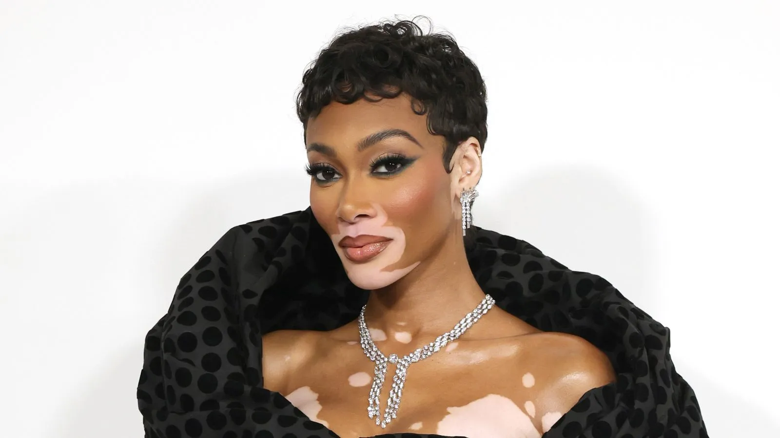 Winnie Harlow' loading='lazy' title=