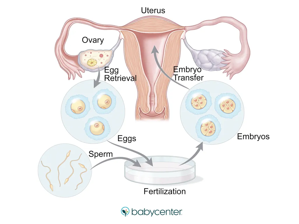 מה יש בהפצה -ויטרו ואיך זה עובד?