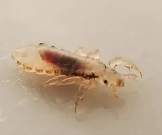 O vinagre mata os piolhos? Especialistas em pragas aconselham sobre a melhor forma de banir esses insetos incômodos