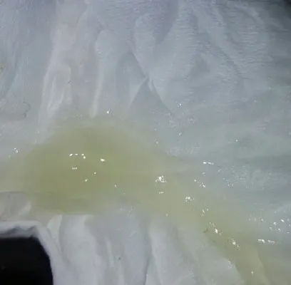 보카 점막 (이미지는 인터넷 제공)