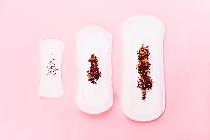 דימום שתל ותסמונת קדם וסתית: איך להבדיל ביניהם?