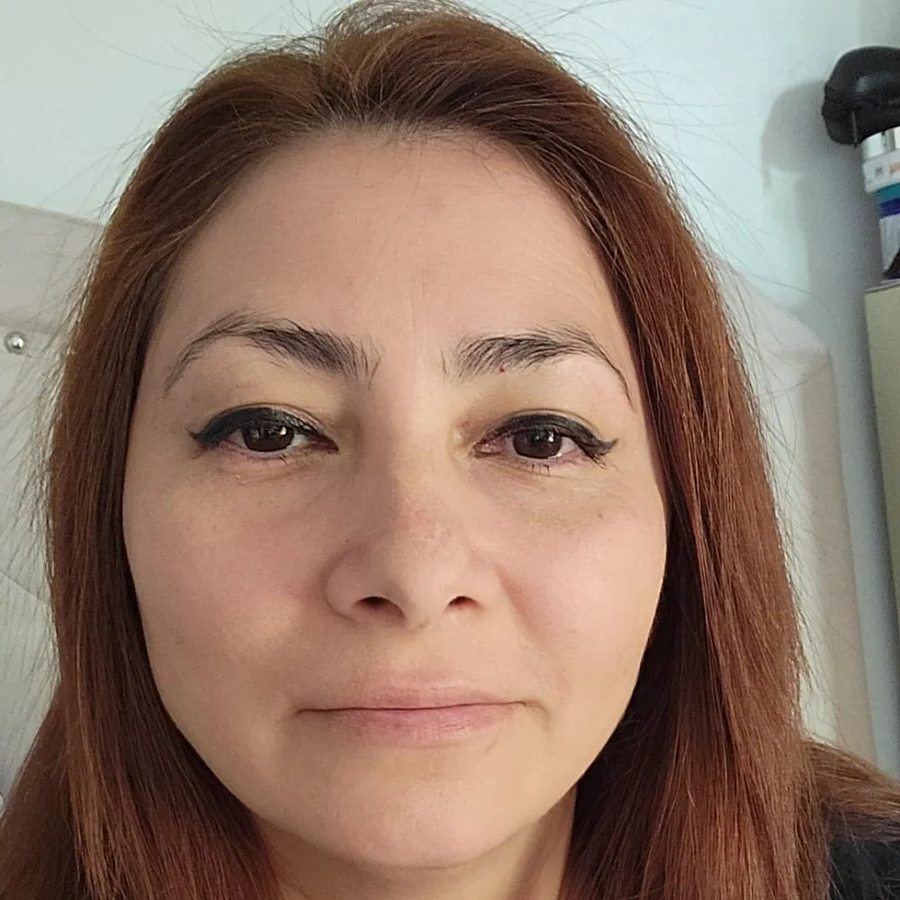 Zdjęcie Sary Arapacio w głowę' loading='lazy' title=